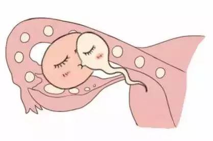 供卵代孕咨询公司试管婴儿中心